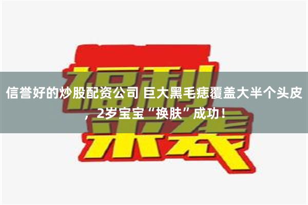 信誉好的炒股配资公司 巨大黑毛痣覆盖大半个头皮，2岁宝宝“换肤”成功！